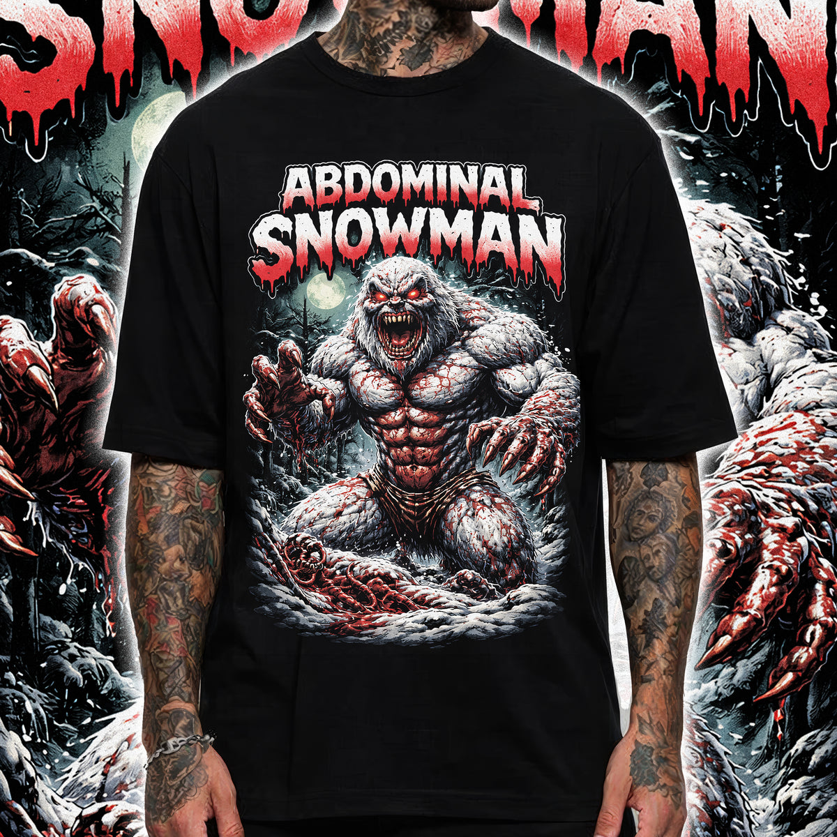 ABDOMINAL SNOWMAN
